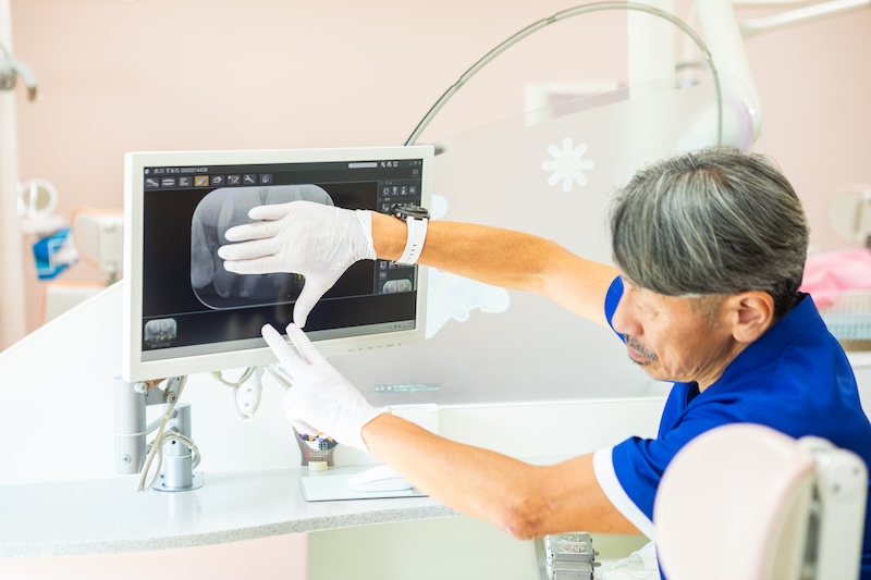 紛失や破損のリスクがある