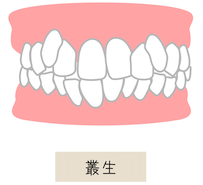 叢生